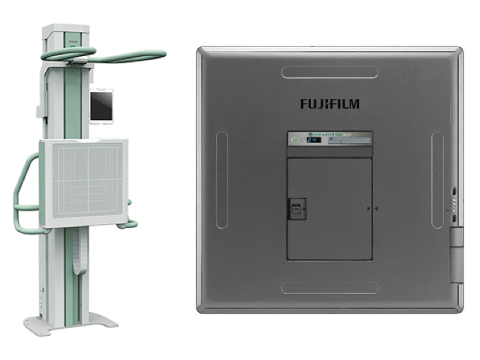 胸部X線検査機器の写真